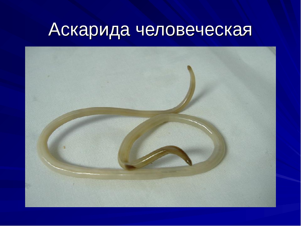 Аскарида тип. Круглые черви аскарида человеческая. Человеческая аскарида червь. Человеческая аскарида Тип червей.