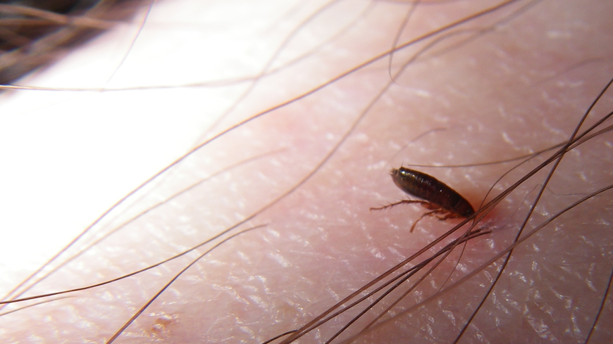 cat flea feeding on a person