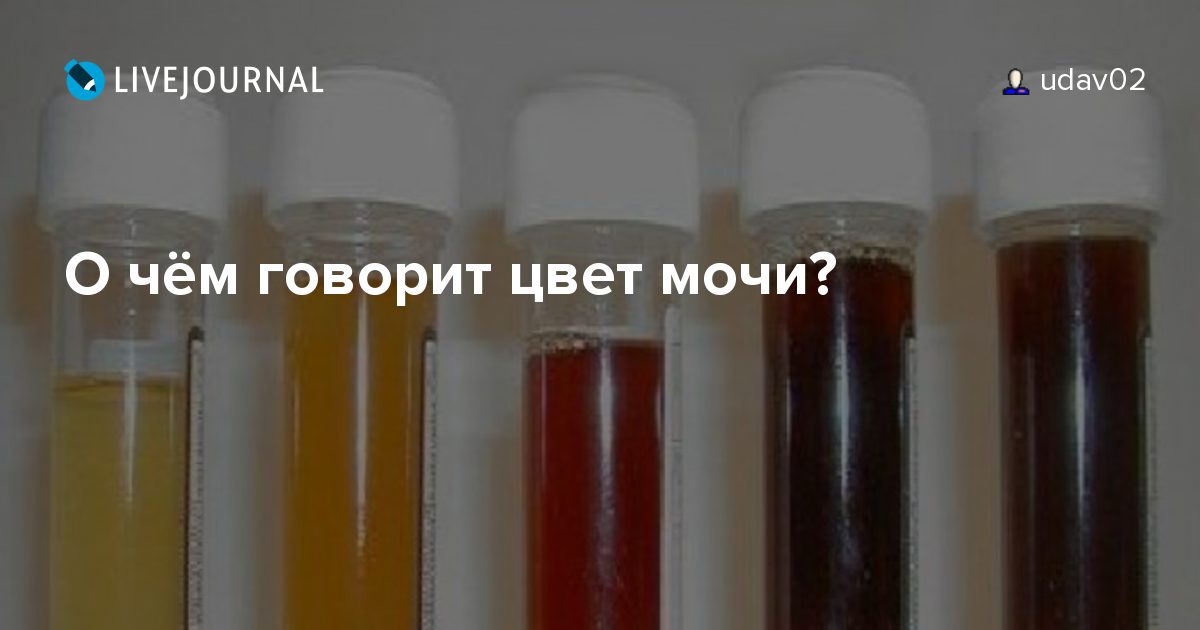 Какая должна быть моча у здорового человека цветом фото